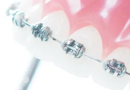 Bracket for orthodontic